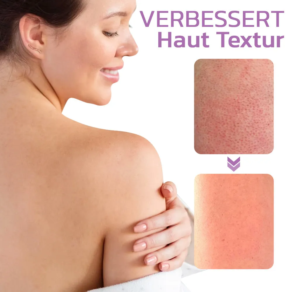 flysmus KP Keratose Gleichgewicht Radiergummi Krper Peeling