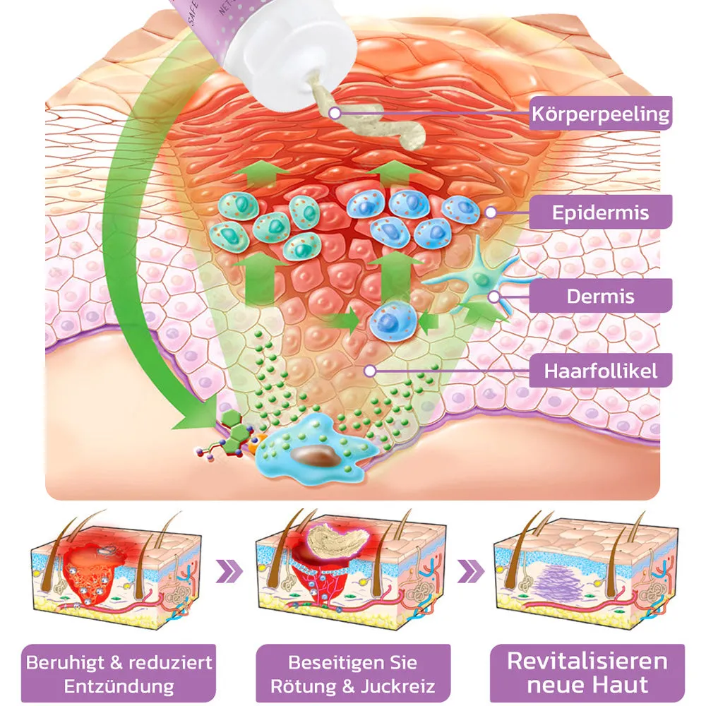 flysmus KP Keratose Gleichgewicht Radiergummi Krper Peeling