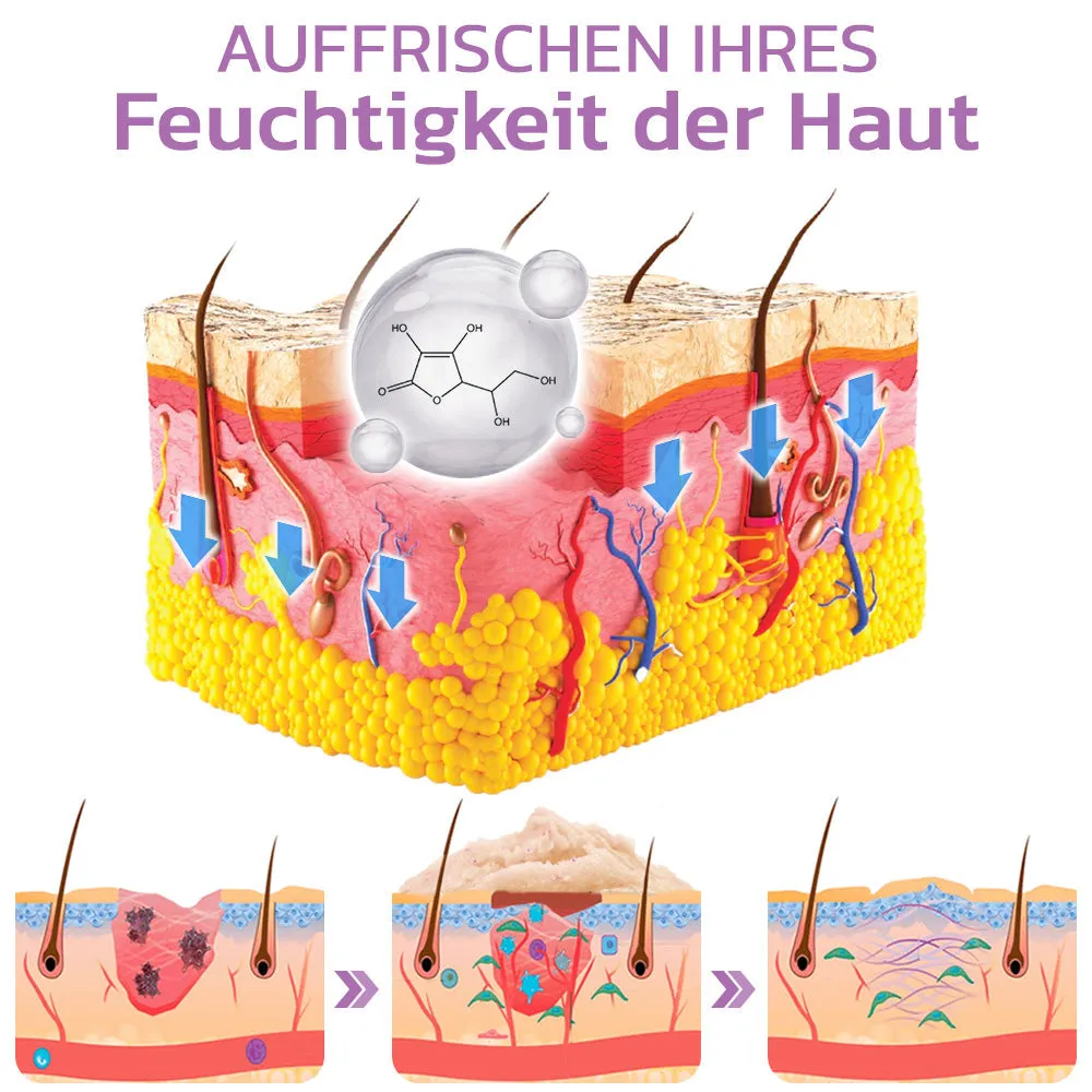 flysmus KP Keratose Gleichgewicht Radiergummi Krper Peeling